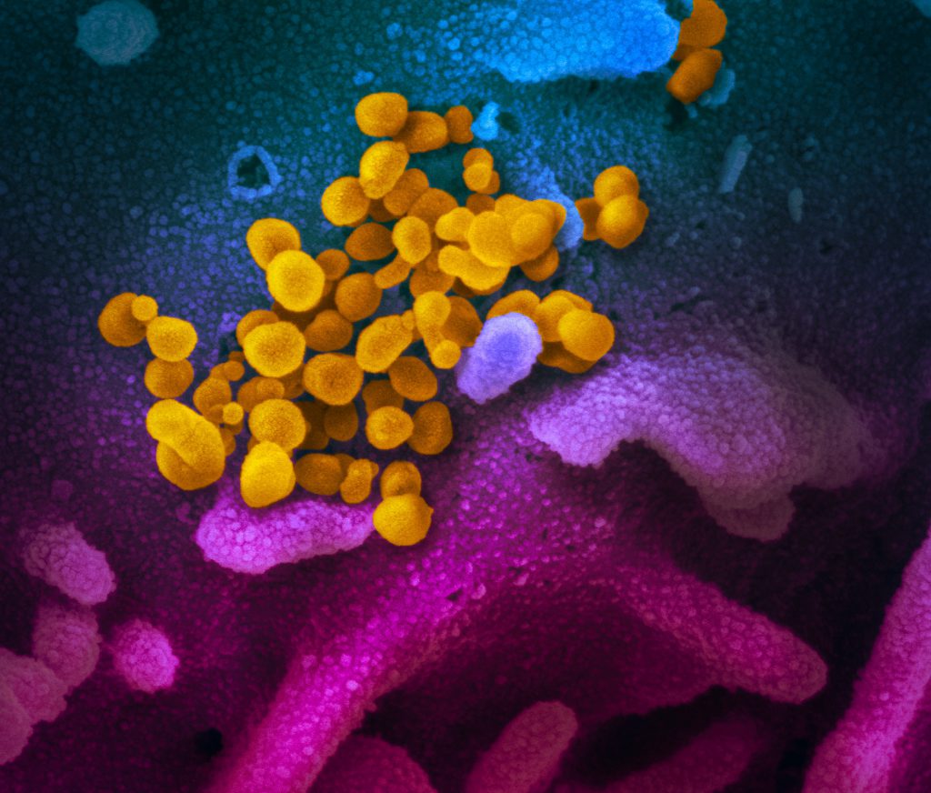 SARS CoV 2 49531042877 Coronavirus COVID-19 electron microscope